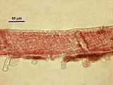 4 - Sezione longitudinale radiale con cistolite